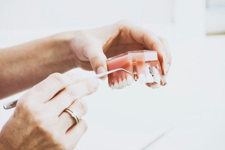 Hochwertige Zahnimplantate und Zahnkronen fertigen lassen: Dentallabor Schmidt Meldorf