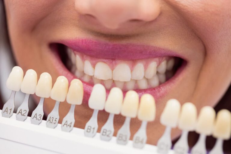 hochwertigen Zahnersatz / Zahnkronen fertigen lassen von einem Zahntechniker